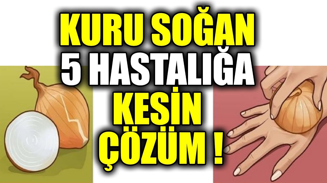 Kuru Soğan Bu Hastalığı Anında İyileştirir - Youtube amaçlanan Rüyada Kuru Soğan Doğradığını Görmek Diyanet