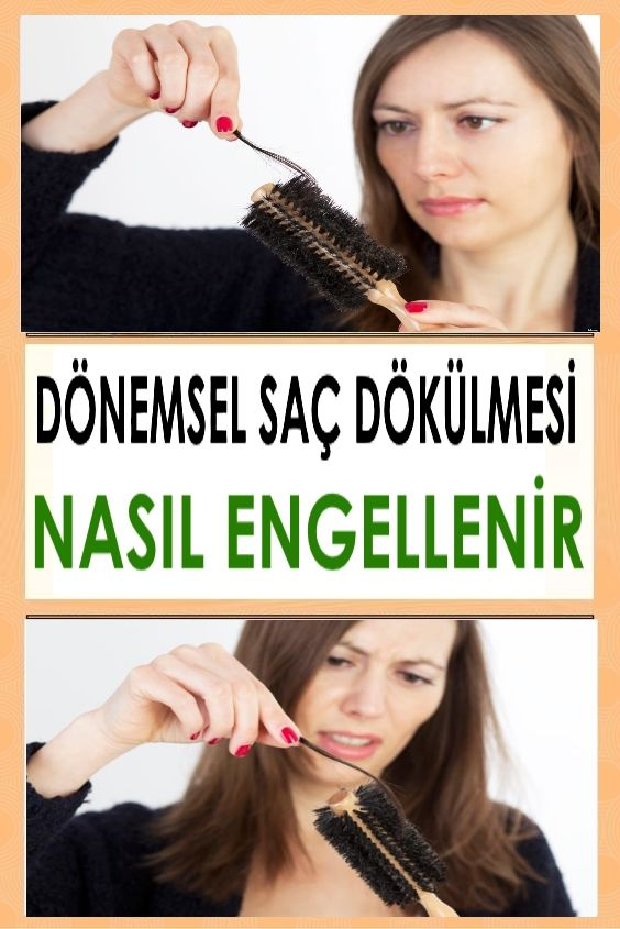 Saç Dökülme Dönemleri | Saç, Saç Bakımı, Saç Dökülmesi tamamen Rüyada Saçların Tutam Tutam Dökülmesi Nedir