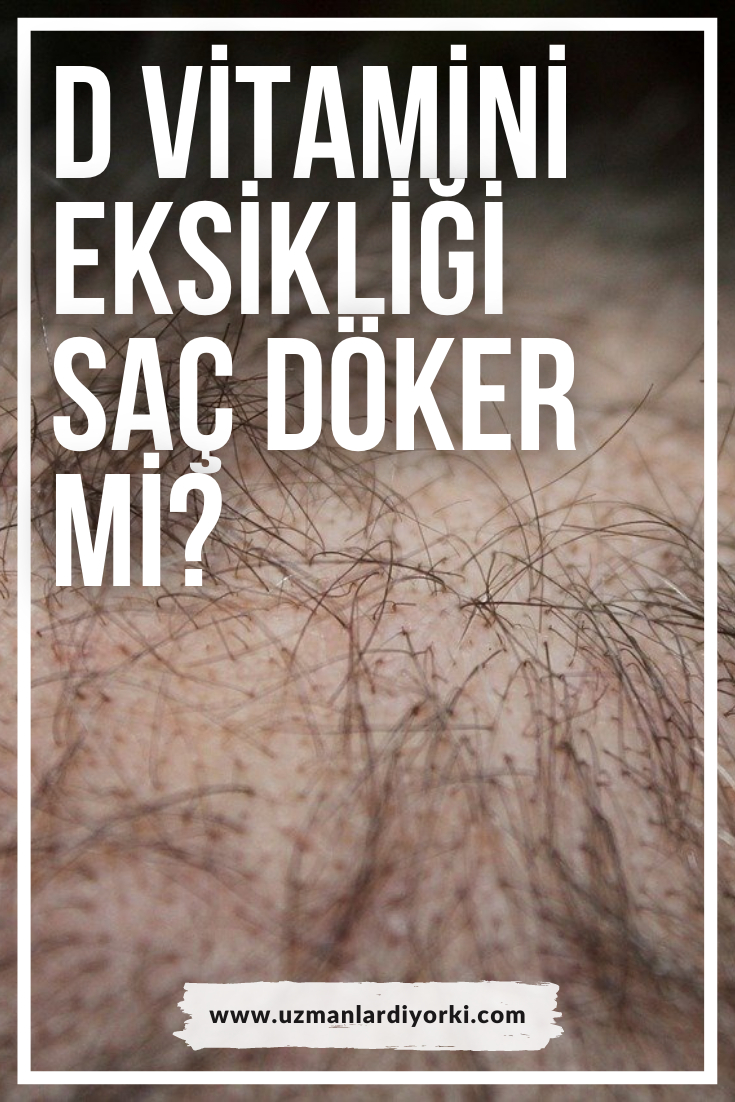 D Vitamini Eksikliği Neden Olur ? D Vitamini Eksikliği Saç Döker Mi? D fiçin Saçta Koparak Dökülme Neden Olur