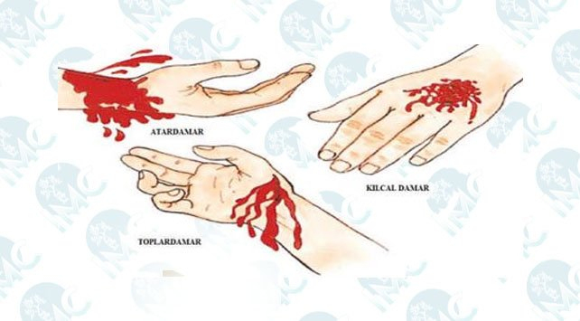 Parmak Ucu Yaralanması Ve Kopması | Op. Dr. İ. M. Çimen ile Saçların Kopması Neden Olur