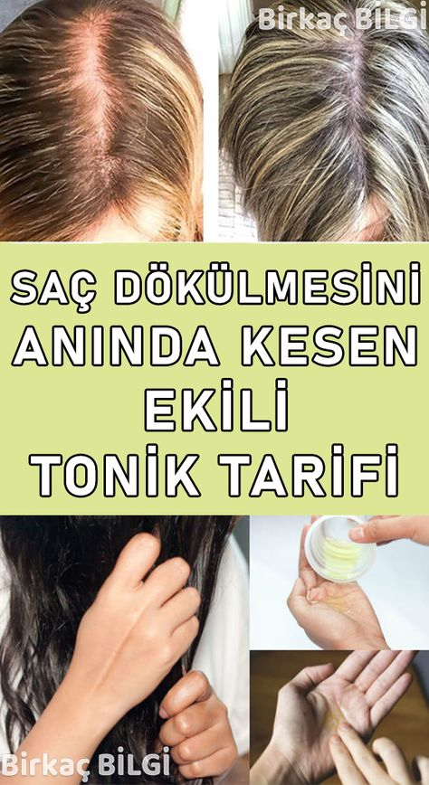 Saç Dökülmesi Genellikle Genetik, Hastalık, Gebelik, Ilaç Ve Yeme ile Saçta Koparak Dökülme Neden Olur