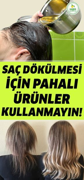 Saç Dökülmesine Ne Iyi Gelir Erkek - Mytimeplus ilgili Saç Dökülmesine Ne Iyi Gelir