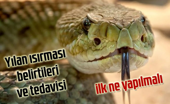 Yılan Isırmasında Ne Yapılmalı, Yılan Isırması Belirtileri Ve Tedavisi fiçin Rüyada Yılan Isırması